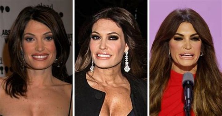 Guilfoyle's Transformation: A Visual Journey From Before To After
